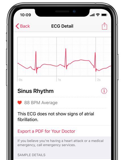 apple watch 4 ecg hack